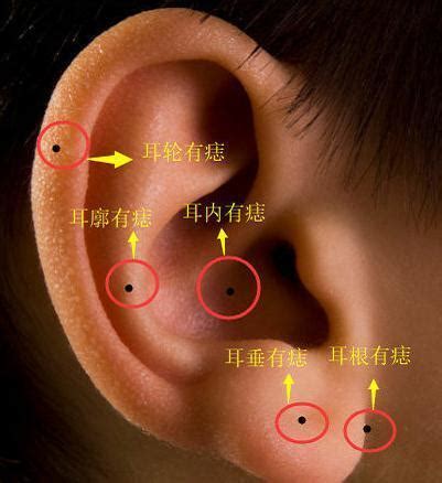 耳垂突然長痣|耳朵长痣的位置图解 耳朵长痣的位置图解有福气